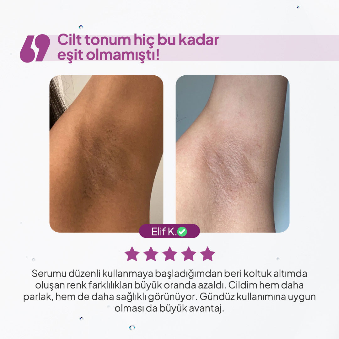 BodyLita Glutathione ve %7 Aktif Serum İçerikli Vücut Serumu