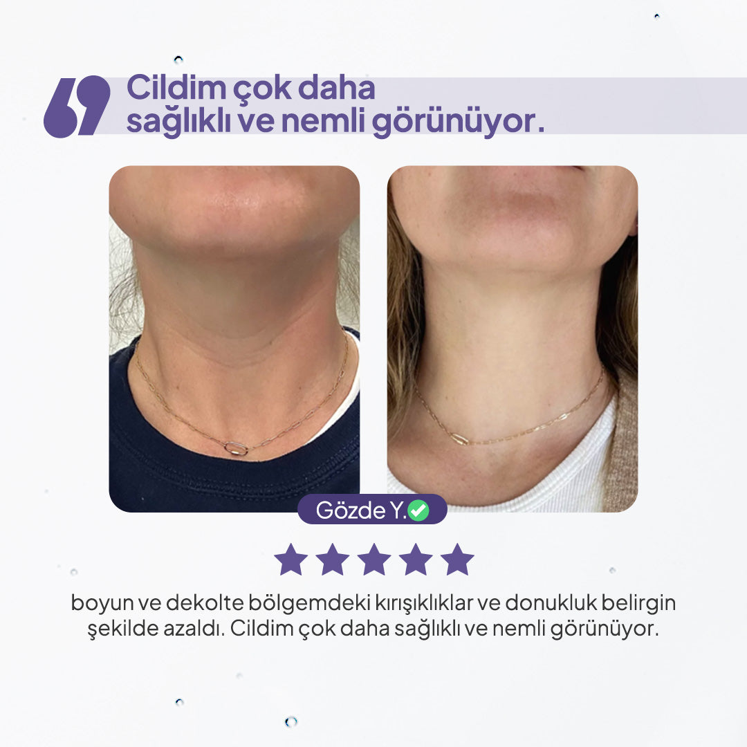 BodyLita Bakuchiol & %8 Aktif Serum İçerikli Vücut Serumu