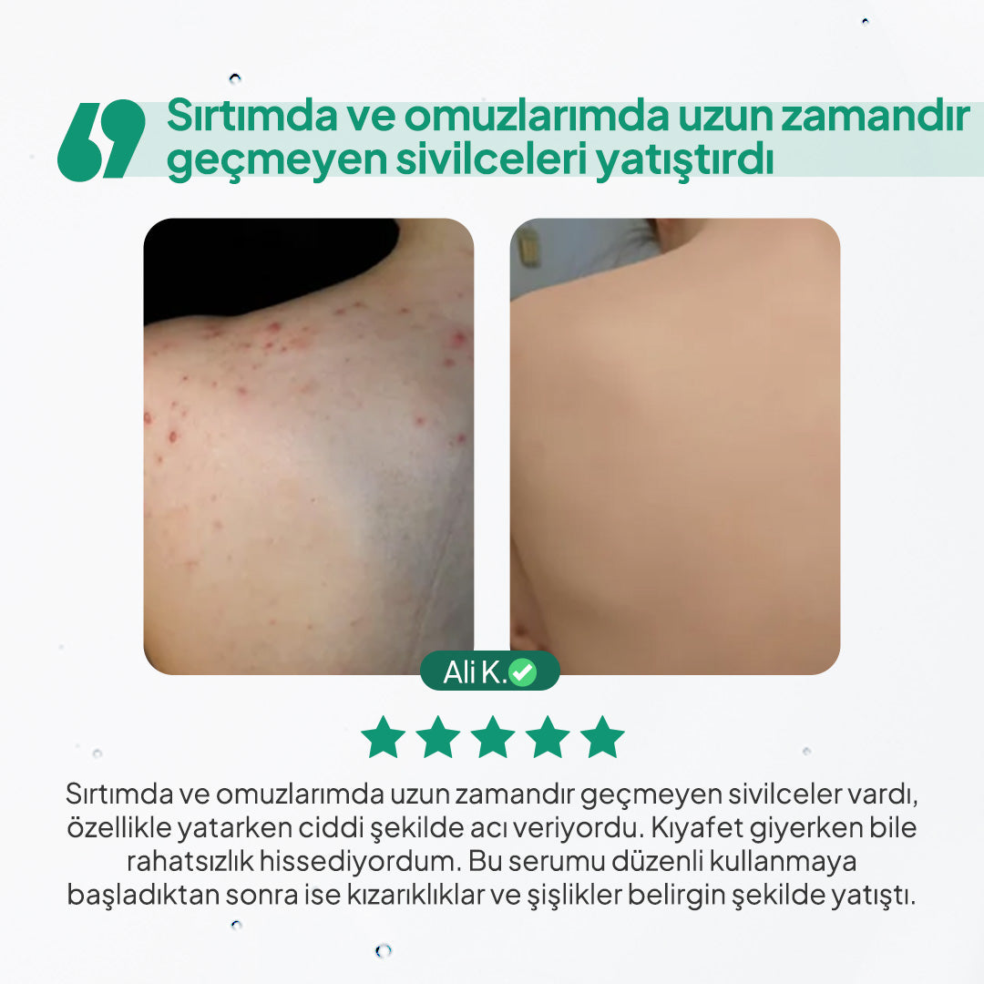 BodyLita Cica ve %9 Aktif Serum İçerikli Vücut Serumu