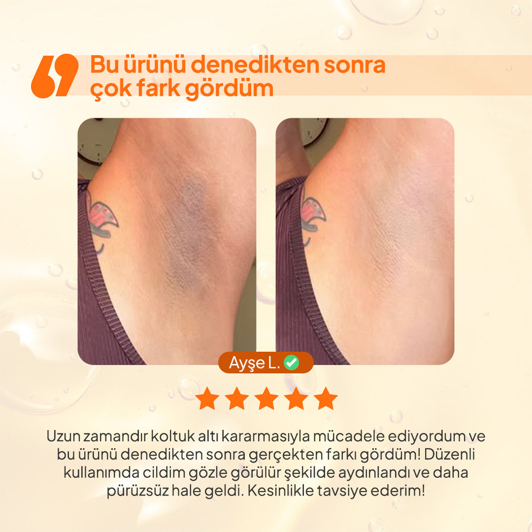 Kojic Acid Kararma Giderici Duş Jeli