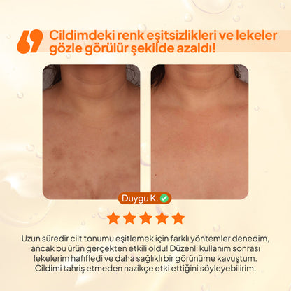 Kojic Acid Kararma Giderici Duş Jeli