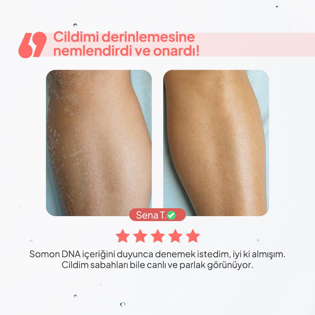 BodyLita Collagen ve %5 Aktif Serum İçerikli Vücut Serumu 