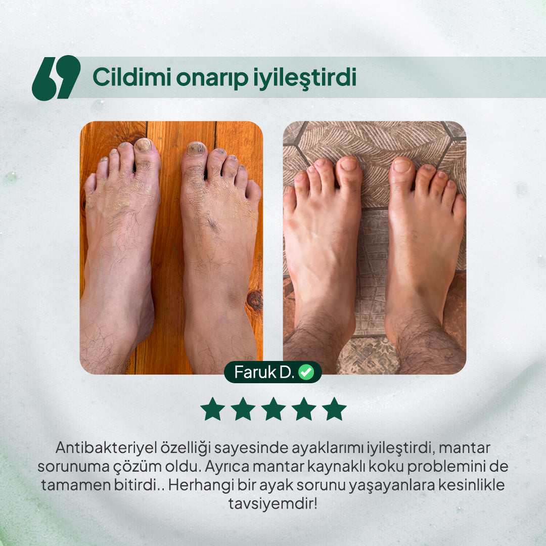 FoamyFoot Ayak Şampuanı